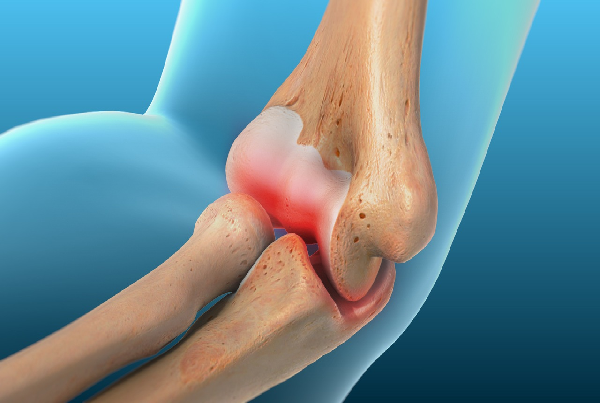 Throwing Injuries