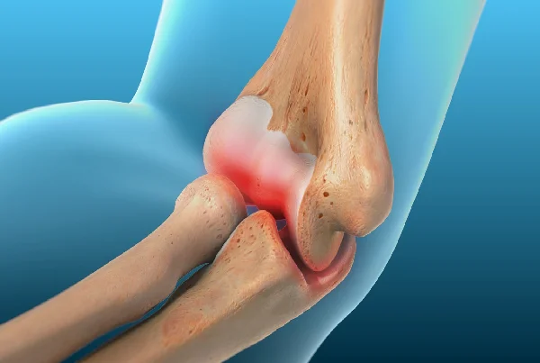 Throwing Injuries